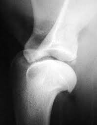 <ol><li><p>X-Ray: easily demonstrated by a mediolateral radiograph (small caudal glenoidal fragment)</p></li><li><p>Arthroscopy.</p></li></ol><p></p>