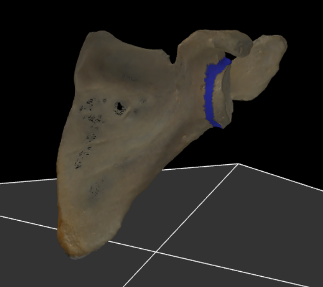 <p><span>deel die de cavitas glenoidalis verbindt met de rest van de scapula</span></p>