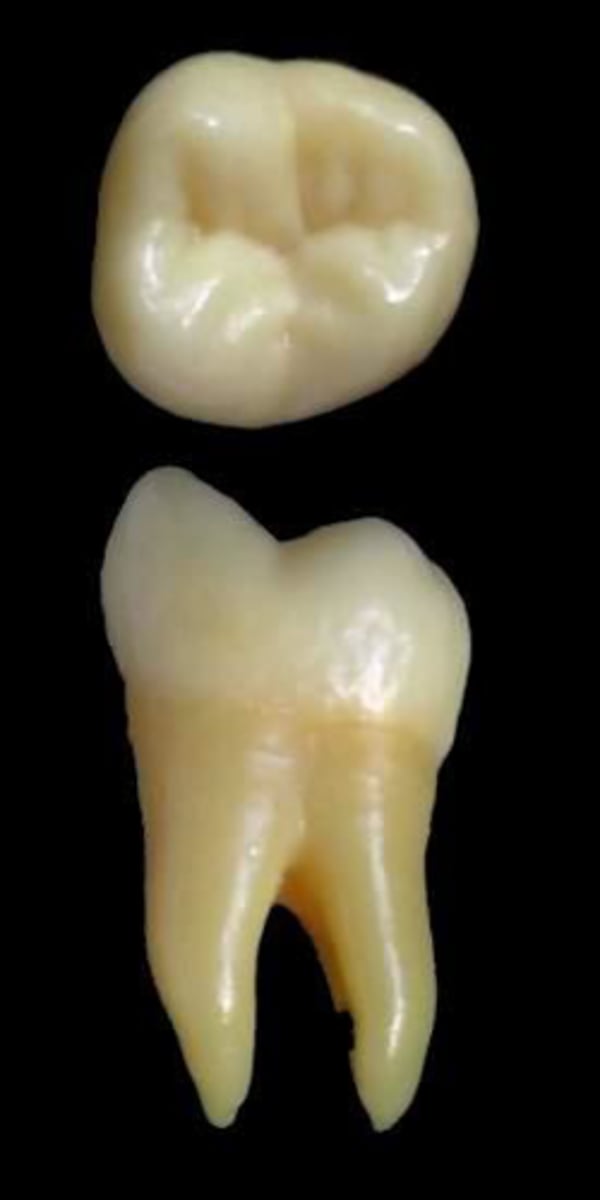 <p>what tooth is this &amp; why?</p>
