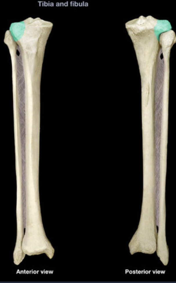 <p>Lateral condyle of tibia</p>