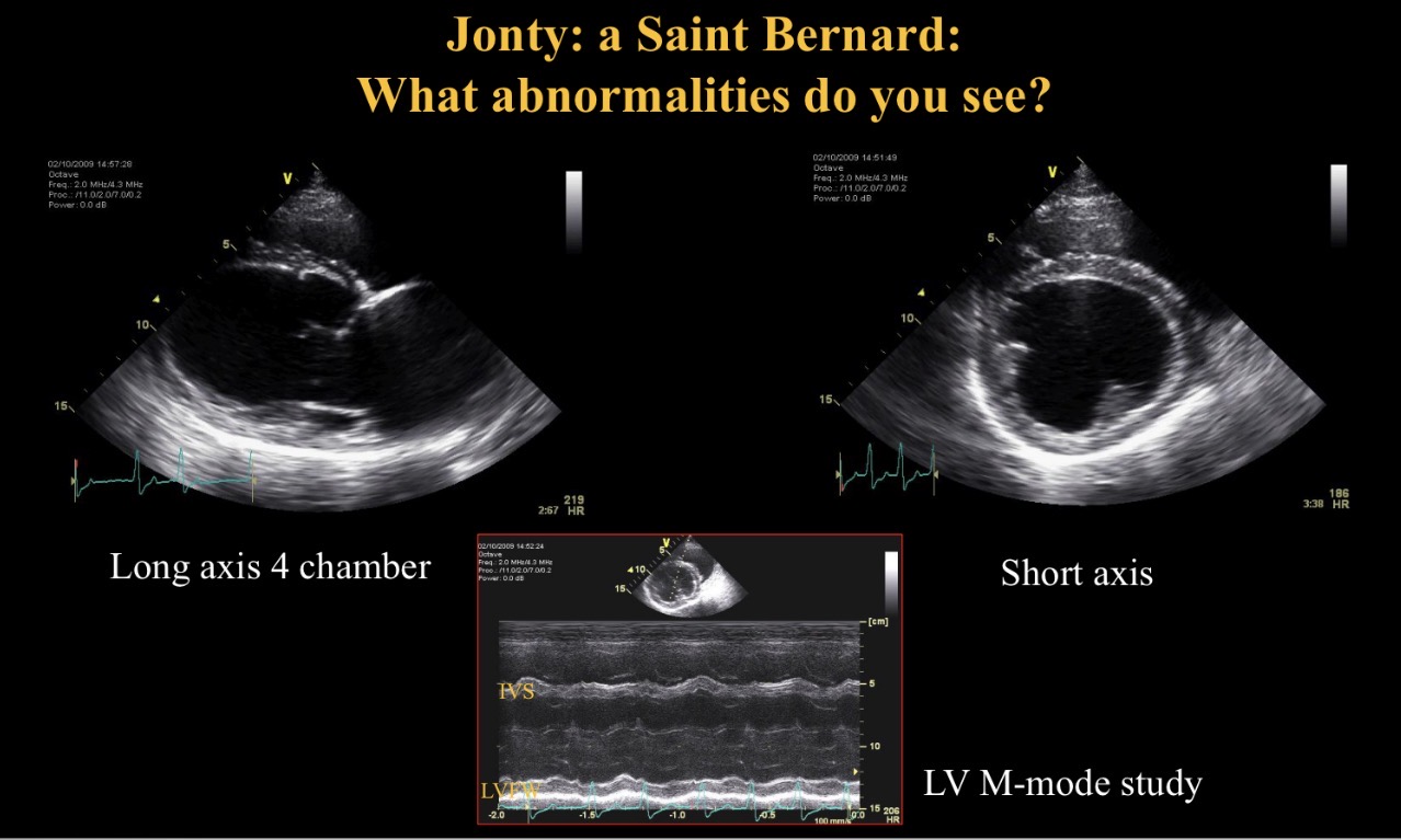<p>Abnormality seen</p>