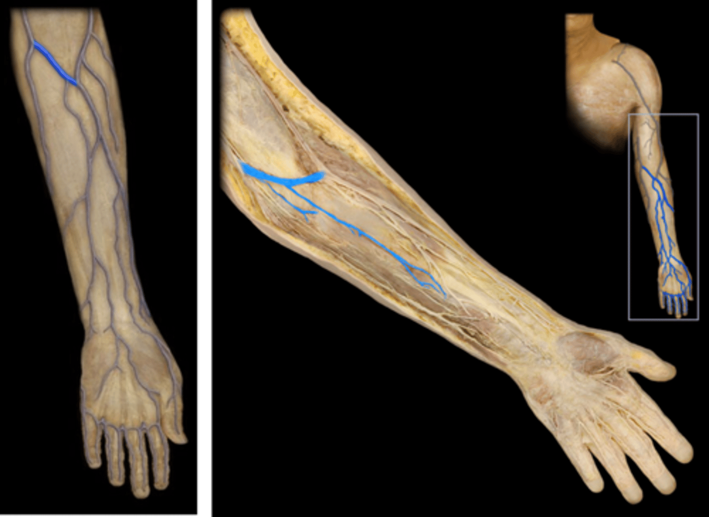 <p>Name this vessel.</p>