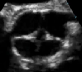 <p>Identify this image. </p>