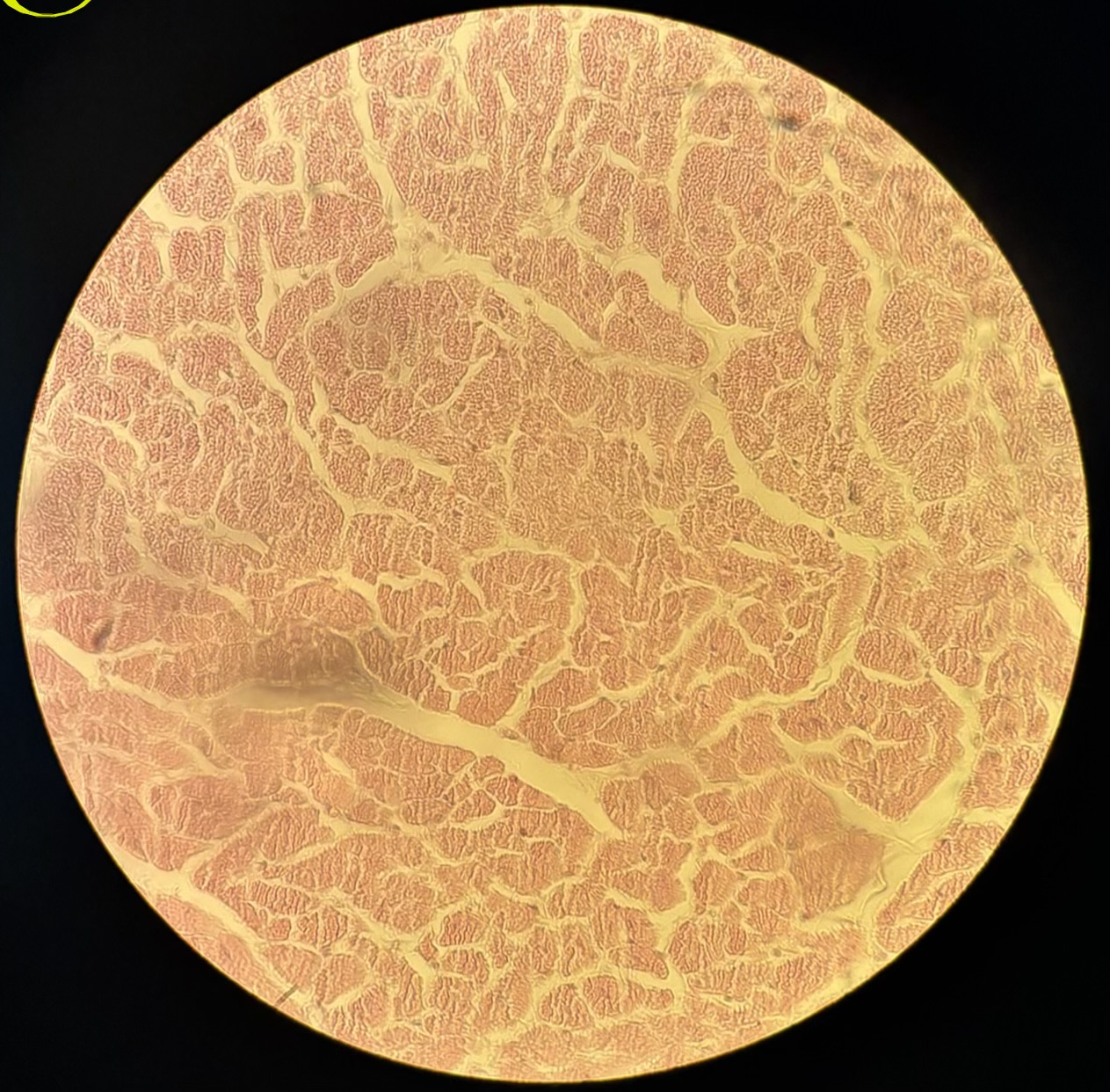 term image