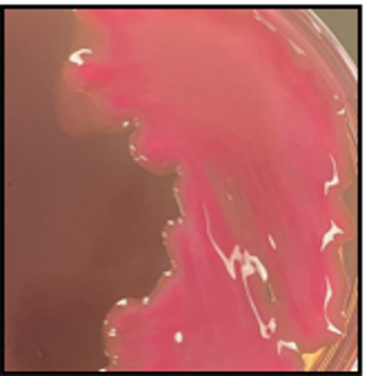 <p>A mare develops post-foaling metritis with fever and purulent vulvar discharge. Uterine swab cytology shows Gram-negative rods.</p><p>See MAC culture </p>