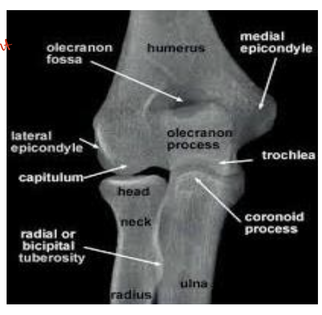 <p>Identify the structures ? view?</p>