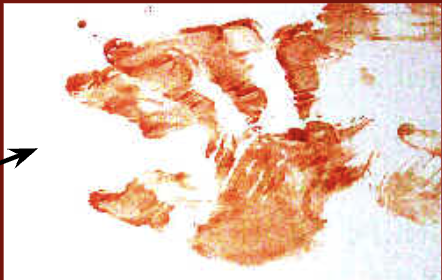 <p><strong>bloody object </strong>comes in contact w/ a surface and leaves a patterned blood image on the surface</p>