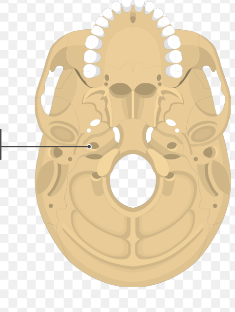 <p>Anterior and medial to the jugular foramen, entry of internal carotid artery</p>
