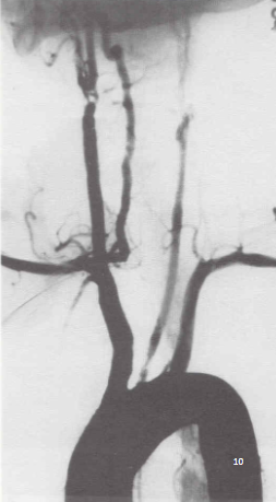 <p>Identify this image. </p>