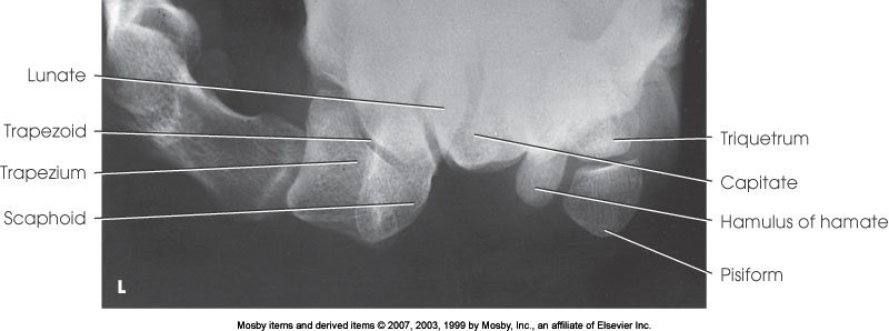 <p>What position is demonstrated?</p>