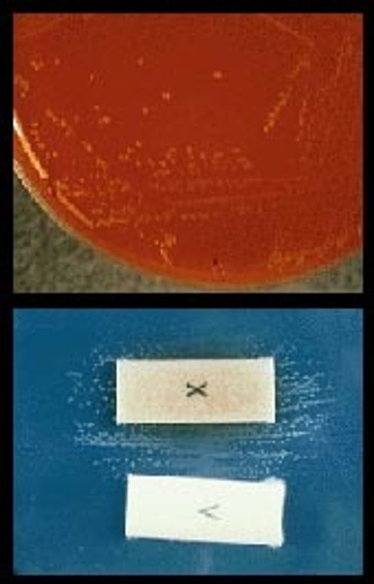 <p>Acute obstructive epiglottitis, both in adults and children, is caused by the bacterial species shown in this split screen photograph. The colonies recovered on chocolate agar (upper frame) required both hematin and NAD, (as shown by colony growth only between the X and V strips in the lower frame). The most likely identification is:</p><p>A. Haemophilus parainfluenzae</p><p>B. Haemophilus influenzae</p><p>C. Haemophilus aphrophilus</p><p>D. Haemophilus haemolyticus</p>