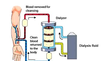 <p>what is the main objective in haemodialysis </p>
