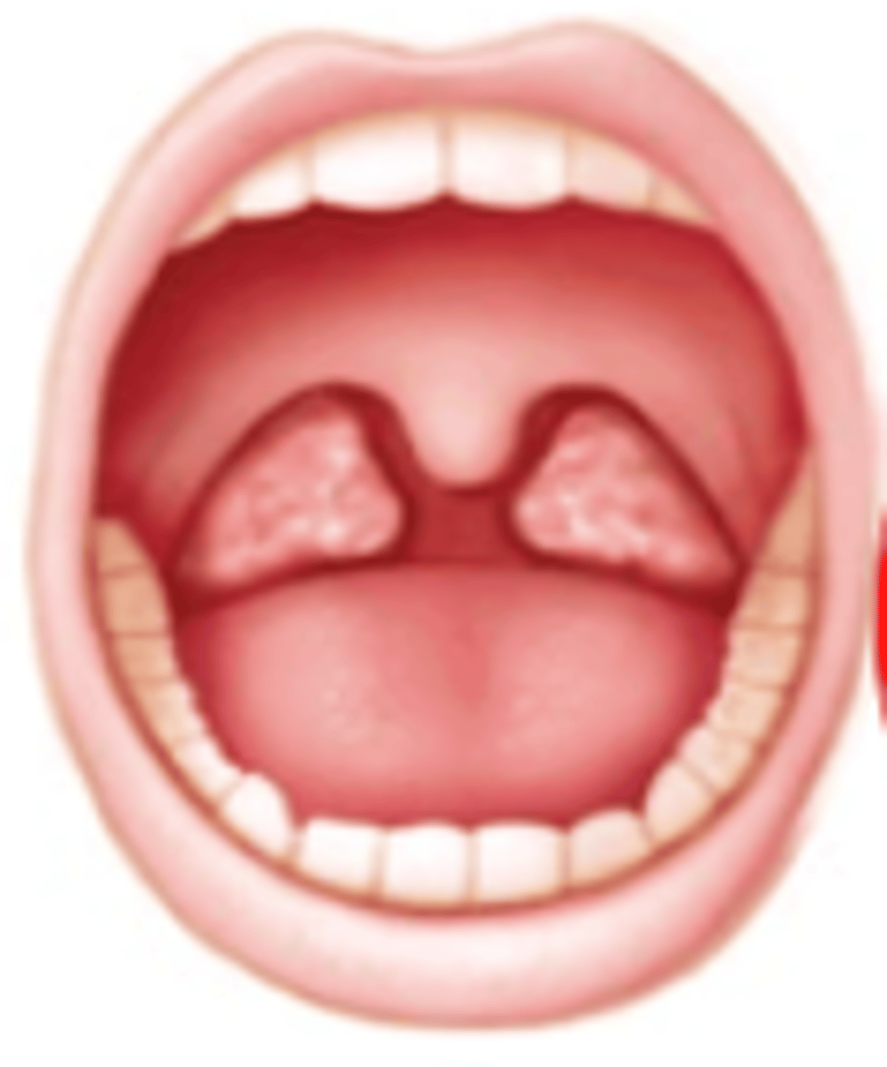 <p>Brodsky:</p><p>Tonsils beyond the pillars</p>