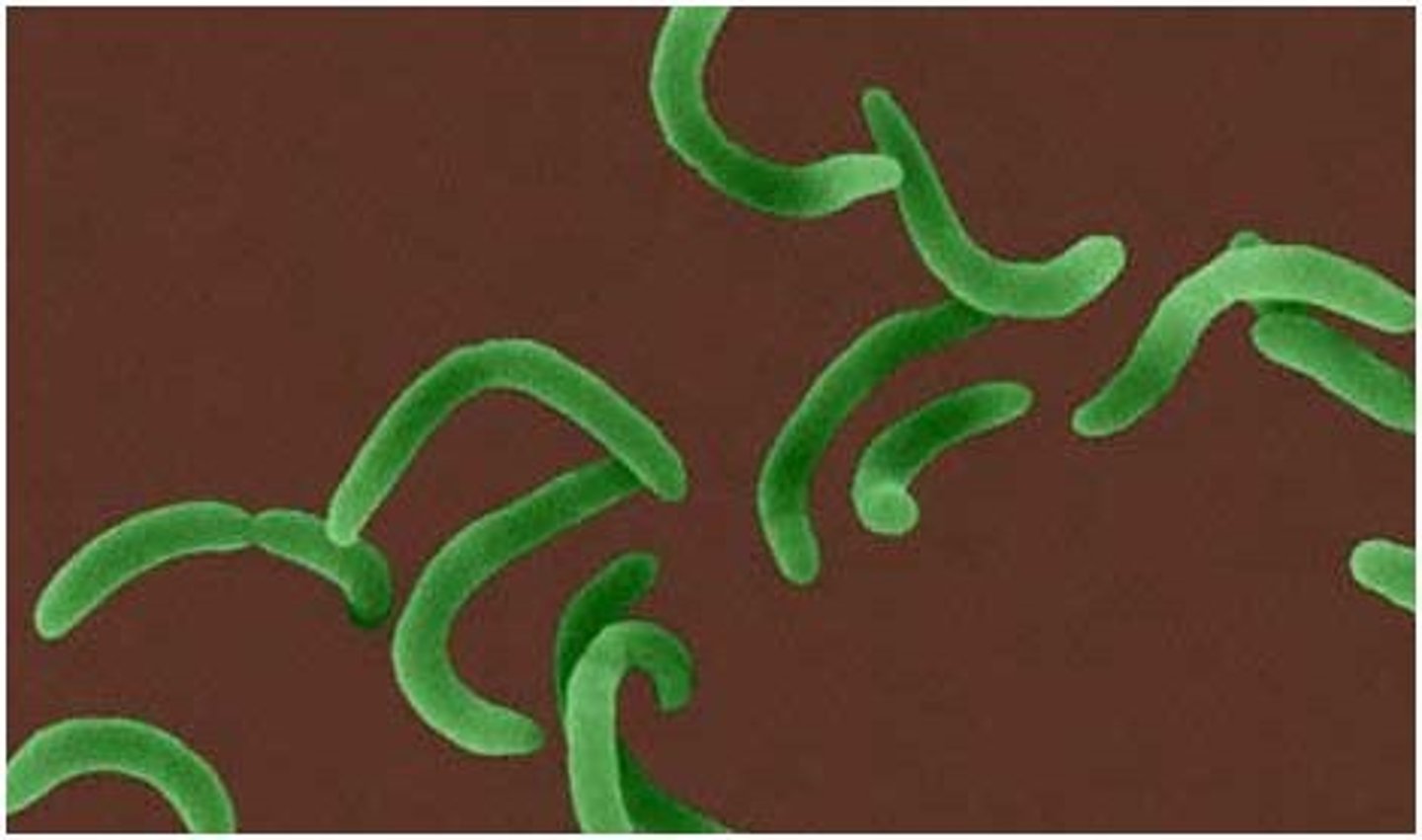 <p>-comma shape</p><p>-1-3 flagella at one end</p>