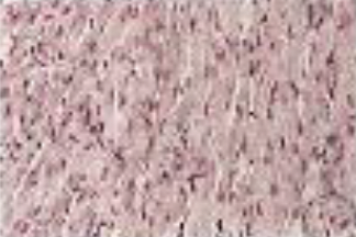 <p>Identifica el tejido</p>