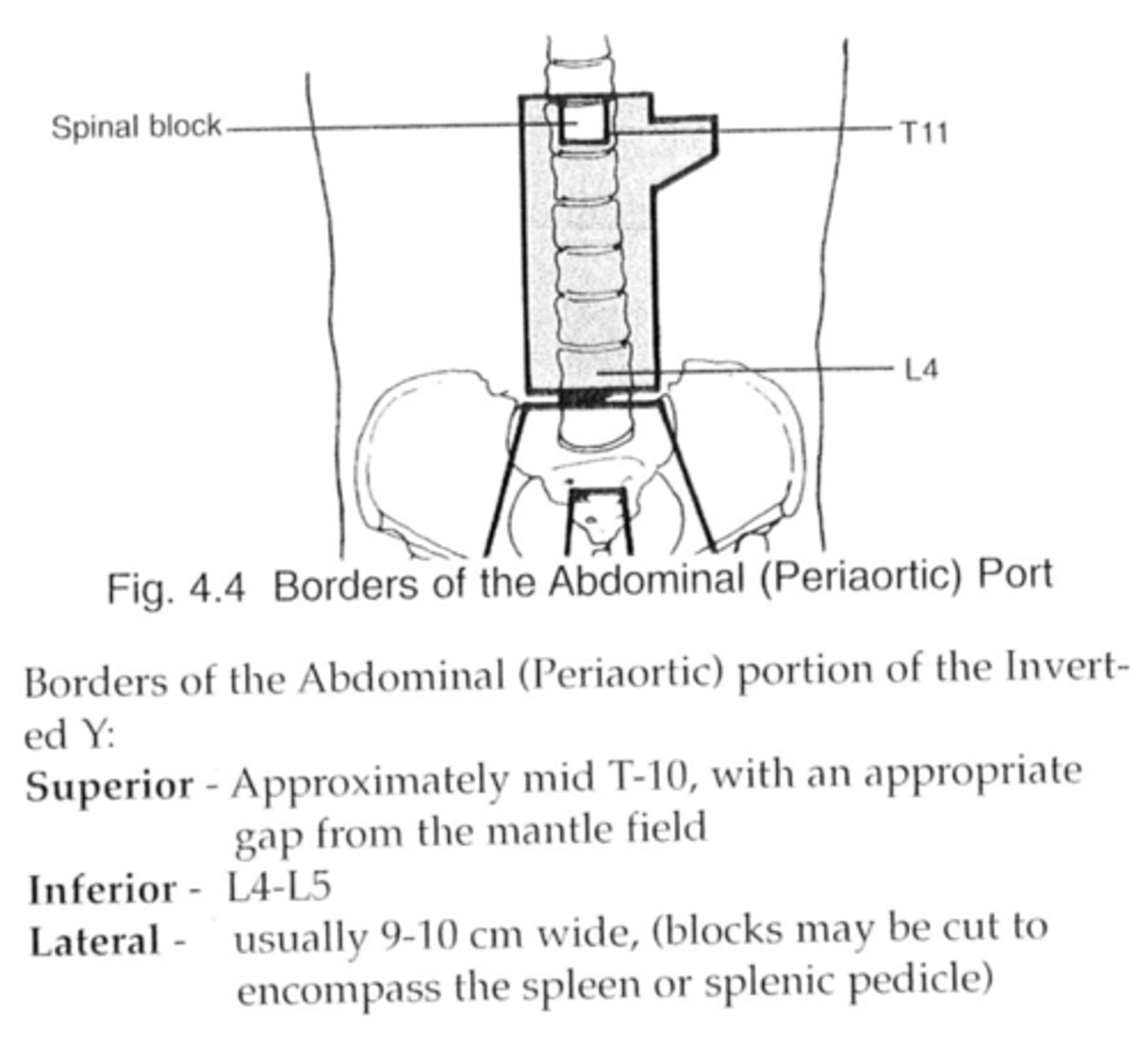 <p>Spleen, para-aortic and retroperitoneal nodes</p>