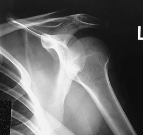 <p>name the position/projection</p>