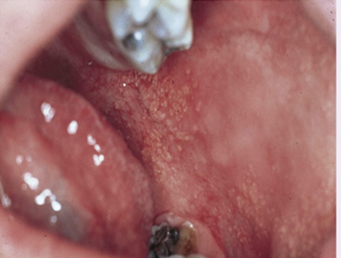 <p>Diagnosis?</p>