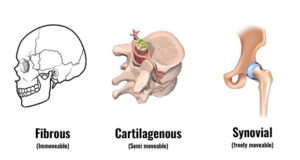 <p>Types of Joints: Arthro-</p>