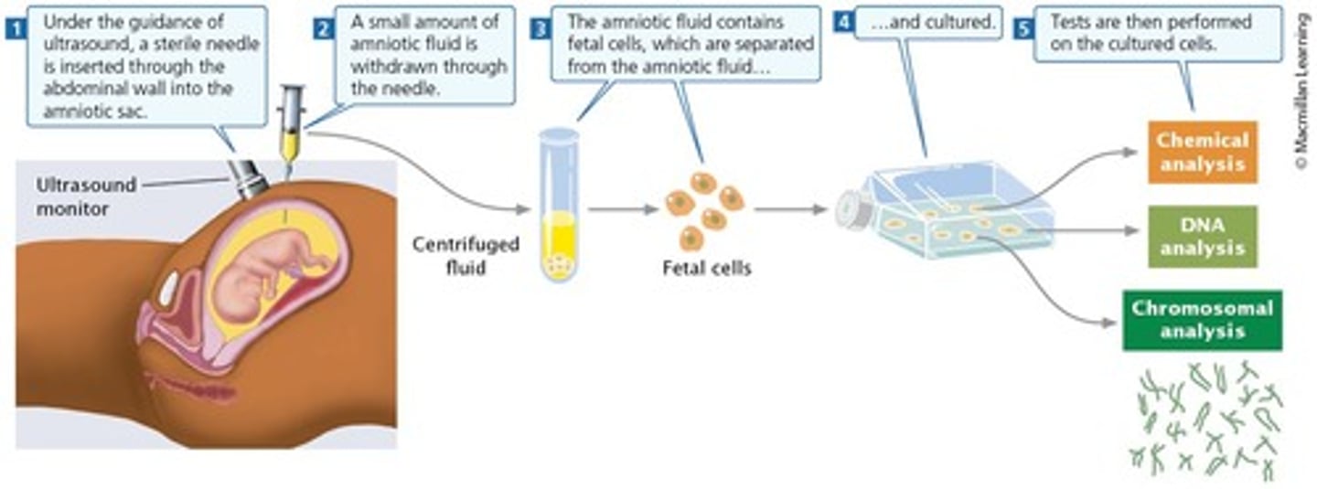 <p>Involves withdrawing amniotic fluid from the uterus, not the fallopian tubes, to perform prenatal testing on fetal tissue.</p>