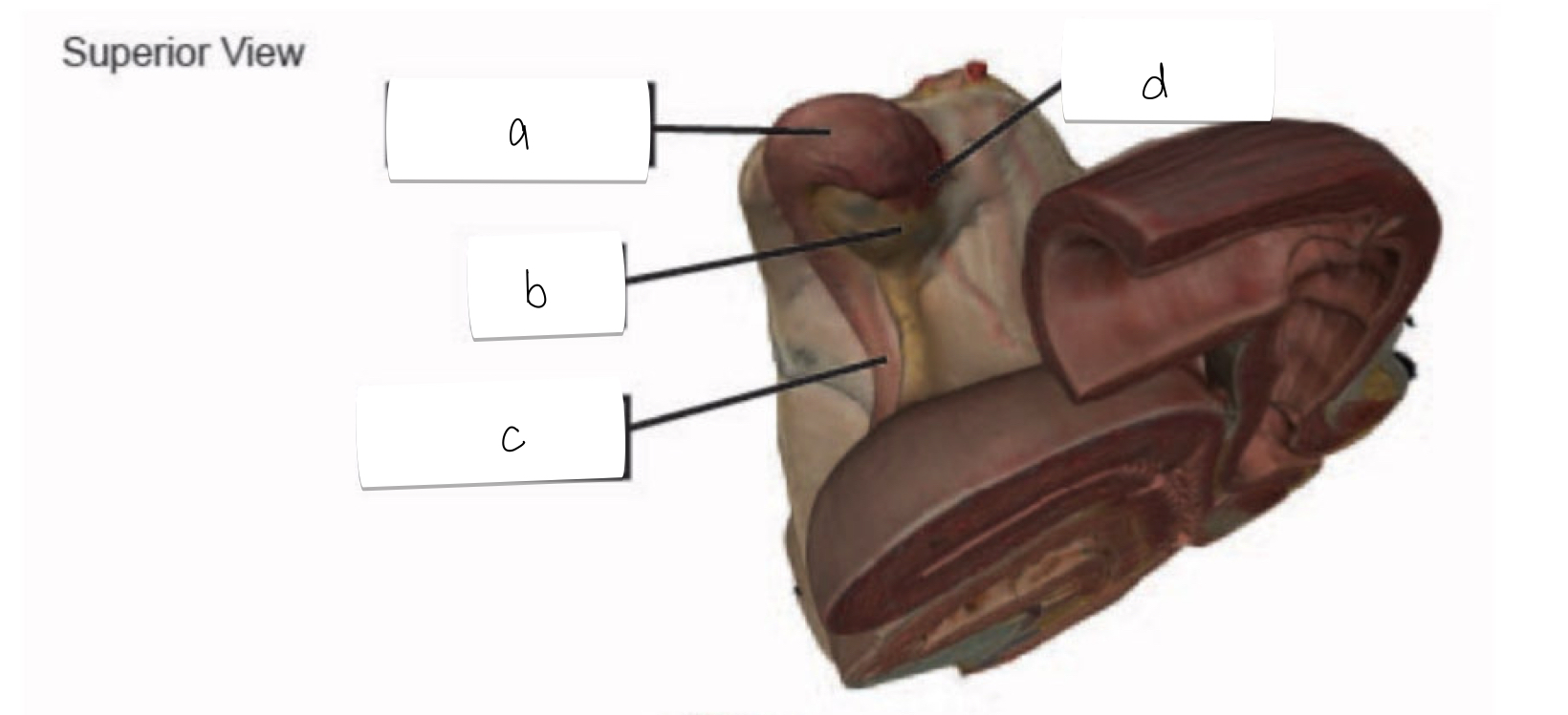 <p>what is labeled d on this superior view of the female reproductive system?</p>