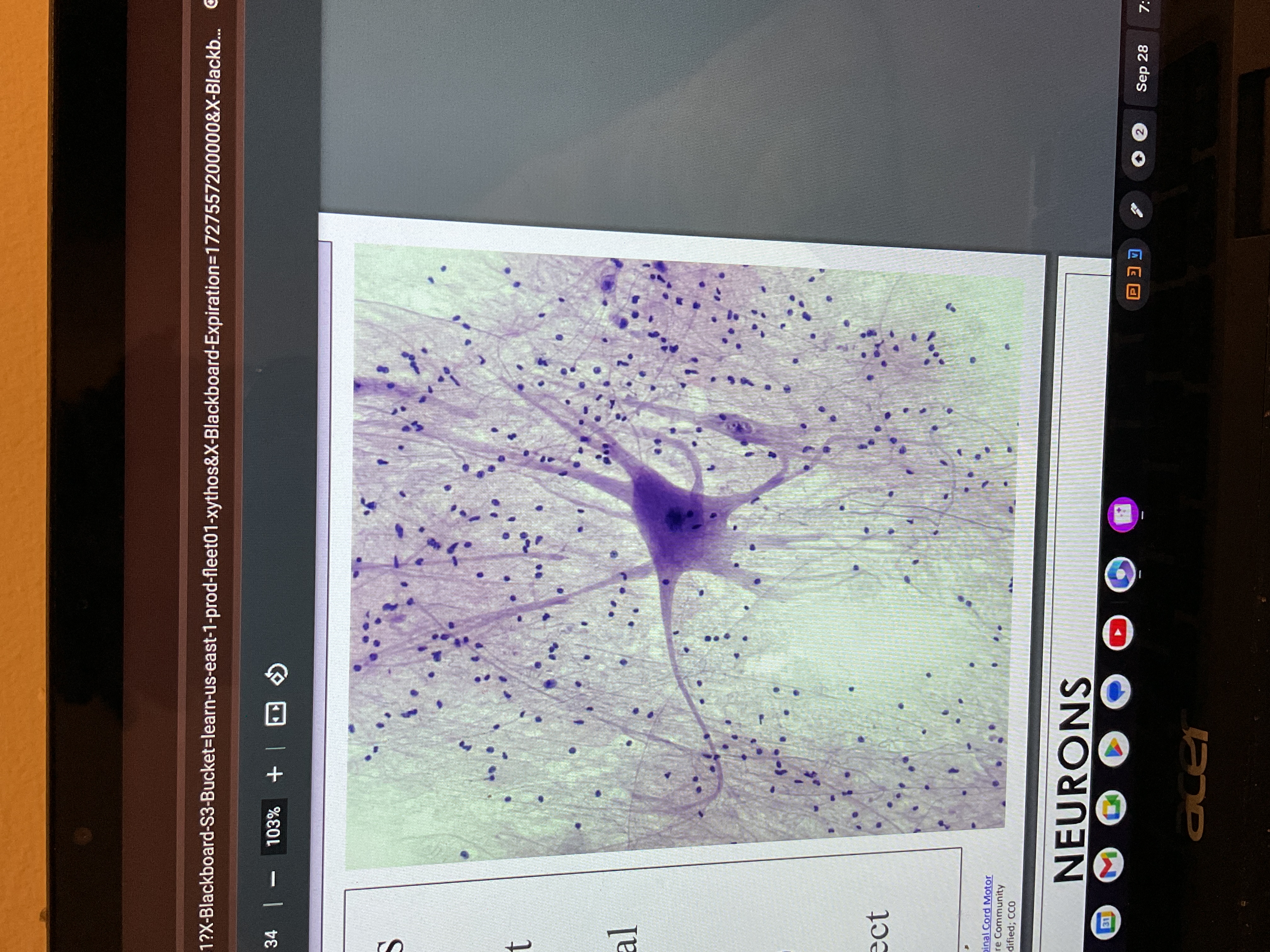 <p>Nervous tissues </p>