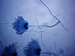 <p>What opportunistic mold looks like a <strong>dandelion</strong>?</p>