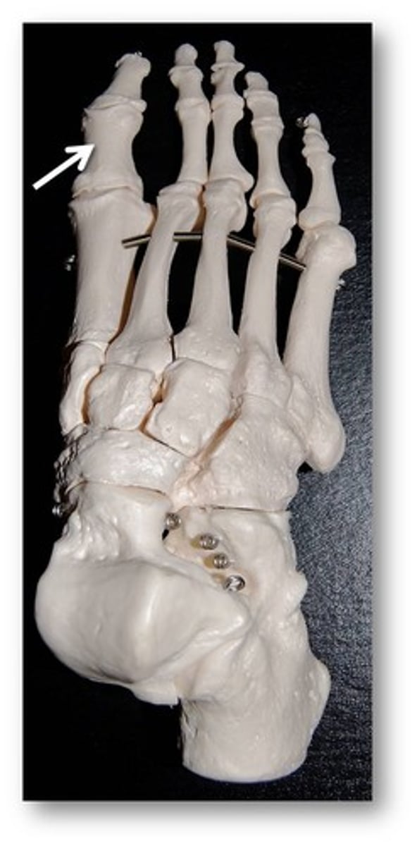 <p>ID specific bone</p>