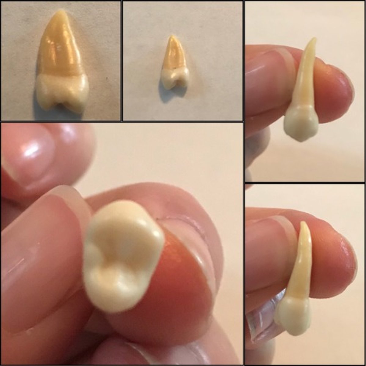 <p>What tooth is this ?</p>