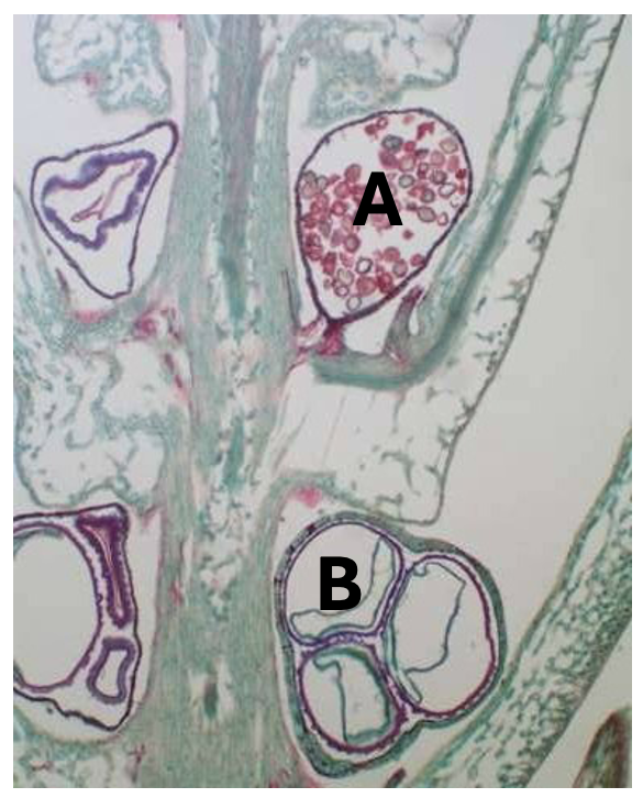 <p>In Selaginella, structure “A” is the:</p><ul><li><p>Microsporangium</p></li><li><p>Megasporangium</p></li><li><p>Micropyle</p></li><li><p>Macropyle</p></li></ul><p></p>