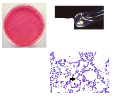 <p>What hemolytic pattern in blood agar medium do this organism produce?</p>