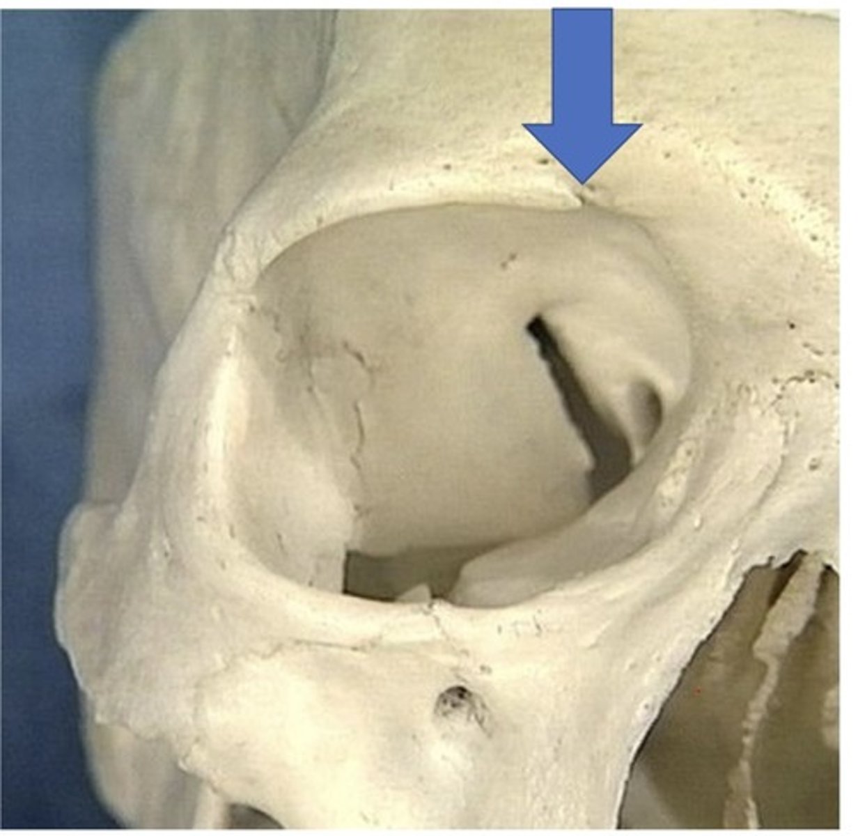 <p>1. May be a notch instead of a foramen in some</p>