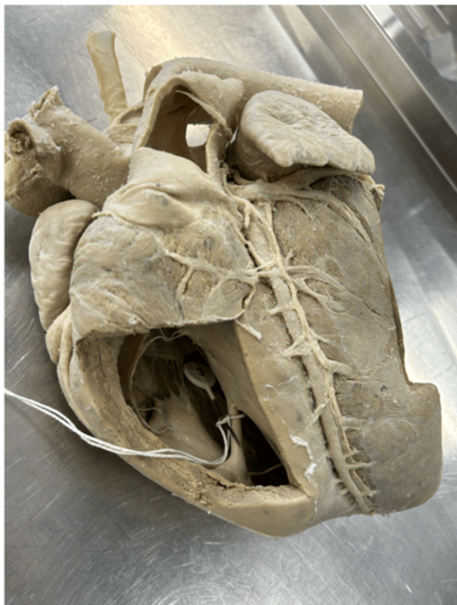 <p>What structure of the cardiac conduction system is found within the structure</p><p>encircled by the string?</p>