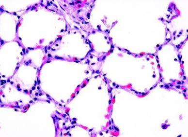 <p>What epithelial tissue is this?</p>