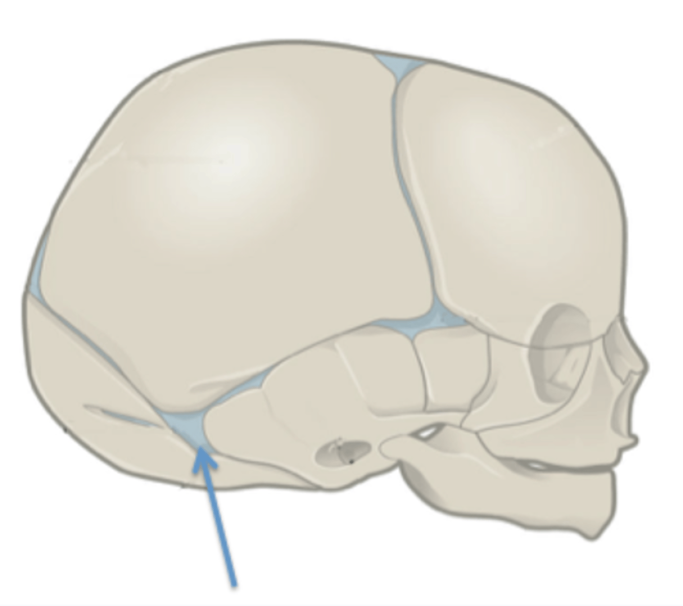 <p>Identify this fetal skull structure.</p>