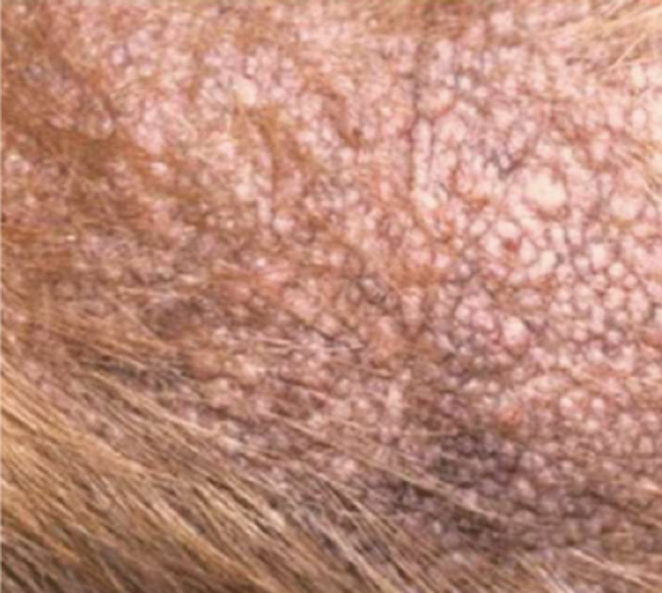 <p>¿lesión?</p><p>¿primaria o secundaria?</p>