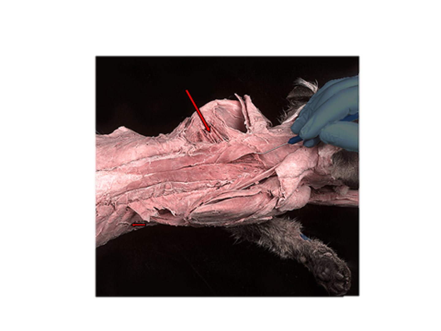 <p>Larger in cats than in humans; pulls together or raises shoulder blades.</p>