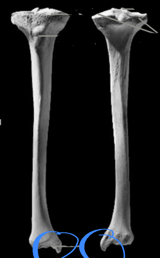 <p>Located on the tibia, articulated with tarsels of the pes</p>