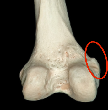 <p>region of bumps of medial condyle of femur </p>