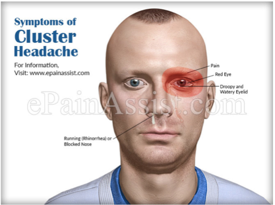 <p>More in males between 20 and 50</p><p>Headache last for a minute to hours</p><p>Example- You have it every day for two weeks and then it doesn’t show up again for another four months</p>