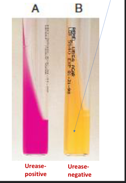 <p>Urease Test</p>
