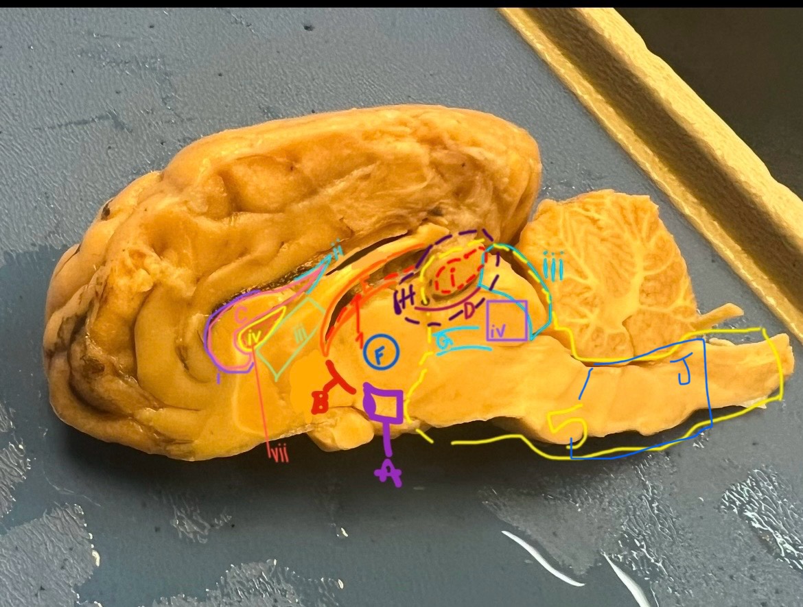 <p>H (specific region)</p>