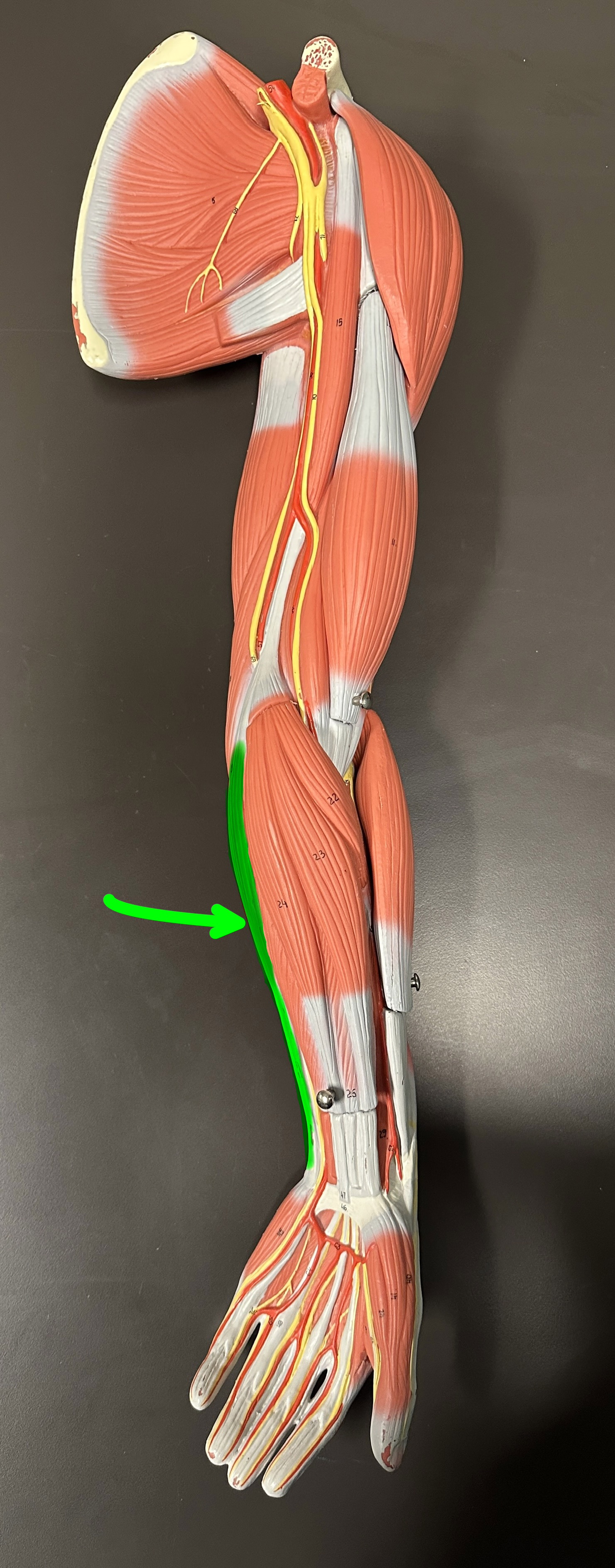 <p>What is the highlighted structure</p>