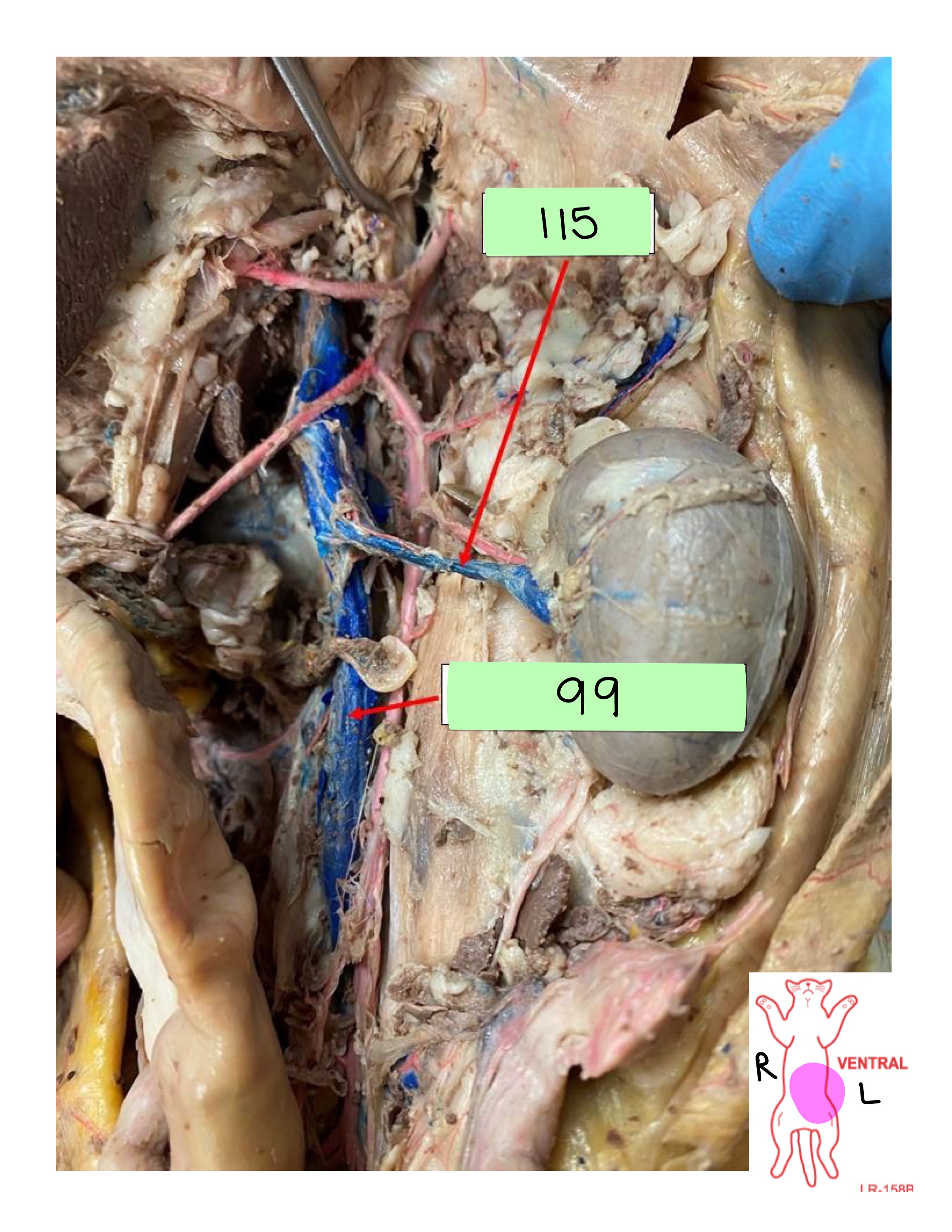 <p>renal vein</p>