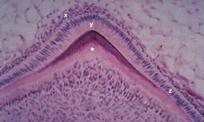 <p><span style="color: #fdfcfc">Identify the tissue marked by the <strong>*</strong> and stained light pink.</span></p>