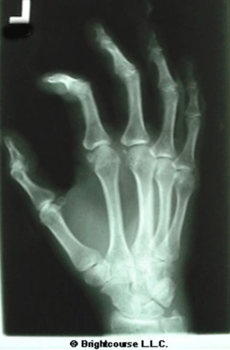 <p>What is the name of the radiographic projection?</p>