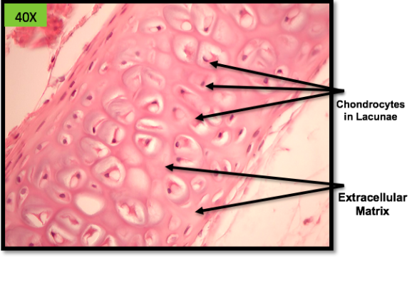 Smooth glassy appears > thick ground >> hyaluronic acid

End of growthing long bone