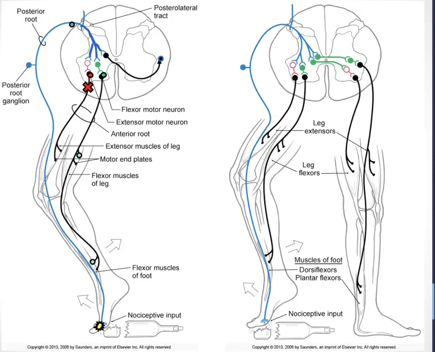 <p><strong><u>flexor withdrawal and flexion-crossed extension:</u></strong> withdrawal of a limb in response to pain (flexor withdrawal) coupled with the opposite response in the contralateral limb (crossed-extension)</p><ul><li><p><strong><u>circuit:</u></strong> afferent limb: pain afferents; efferent limb: alpha-motor neurons</p><ul><li><p>afferents form excitatory and inhibitory connections with interneurons</p></li><li><p>excitatory interneurons synapse with alpha motor neurons in the ventral horn of the SC that innervate the muscles required for the flexor withdrawal</p></li><li><p>inhibitory interneurons synapse with alpha motor neurons in the ventral horn of the SC that innervate the antagonist muscle</p></li><li><p>excitatory interneurons synapse with alpha motor neurons in the ventral horn of the SC that innervate the muscles required for extension of the opposite limb</p></li><li><p>inhibitory interneurons synapse with alpha motor neurons in the ventral horn of the SC that innervate the antagonist muscle of the opposite limb</p></li></ul></li><li><p><strong><u>function:</u></strong> plays a major role in responding to dangerous stimulation and coordinating activity on both sides of the body for balance and postural adjustments</p></li></ul><p><strong><u>image</u></strong></p><ul><li><p>sensory/pain information will come in (i.e. nociceptors); feedforward excitation</p><ul><li><p>e.g. stepping on glass</p></li></ul></li><li><p>AP comes in, diverges, and…</p></li><li><p>…activates 3 different populations of interneurons</p><ul><li><p>1. activate alpha motor neurons/muscles required to pull limb away from the source of pain (e.g. flexion of knee= activation/contraction of hamstrings) </p></li><li><p>2. activation of inhibitory interneuron, which shuts down antagonist muscles needed for reciprocal inhibition (e.g. contraction of hamstrings= shutting down/relaxation of quadriceps)</p></li><li><p>3. excitation of an interneuron that will cross to the other side of the spinal cord, to then initiate the crossed-extension response </p><ul><li><p>cross-extension is needed for the lower limb reflex, as you need to maintain a standing balance when you pull that limb away </p></li></ul></li></ul></li><li><p>signal travels to the opposite side of the spinal cord</p></li><li><p>interneurons will activate the appropriate alpha motor neuron on the other side to inhibit the alpha motor neurons that innervate the antagonist </p></li><li><p>stabilize the person when they’re pulling their leg away </p><ul><li><p>e.g. contraction of quadriceps to maintain knee in extension + inhibition of hamstrings for reciprocal inhibition </p></li></ul></li></ul><p></p>