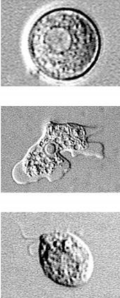<ul><li><p>Classified as a free-living protozoan</p></li><li><p>Found worldwide in soil and contaminated water environment</p></li><li><p>Can survive in thermal spring water</p></li><li><p>Known pathogen worldwide is <strong><em>Naegleria fowleri</em></strong>, which is the only amoeba with 3 identified morphologic forms - trophozoites, flagellate, and cyst forms</p></li><li><p><strong>The trophozoite:</strong> exhibits amoeboid motility, “slug-like'.</p></li><li><p><strong>Flagellate Form: </strong>pear-shaped; equipped with 2 flagella that is responsible for the parasite’s jerky or spinning movement.</p></li><li><p><strong>Cyst: </strong>non-motile form</p><p>&gt;The amoeboid trophozoite form is however the only form that is known to exist in humans</p></li></ul><p></p>