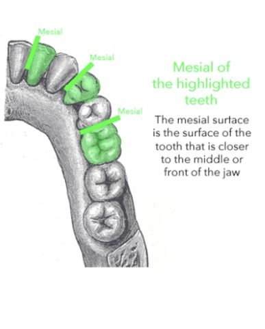 <p>Surface of any tooth nearest to the midline </p>